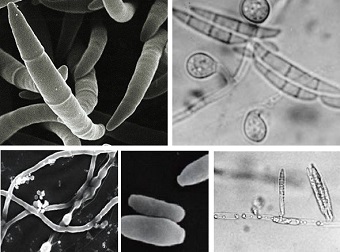 fusarium black mould spores